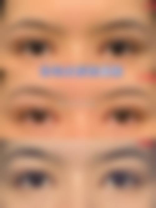 北京臻悦医疗美容诊所实例参考