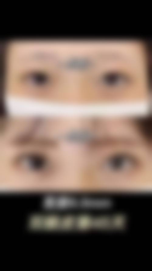 成都真美奇迹整形医疗美容诊所实例参考