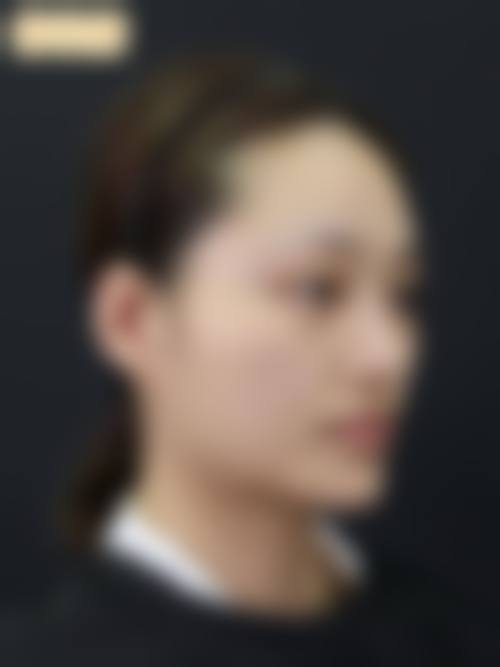 韩国EFIL整形医院 - 面部轮廓专科怎么预约？