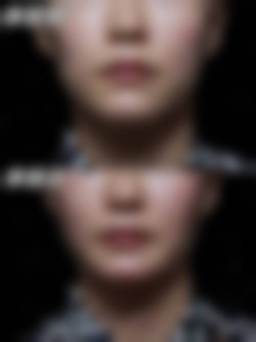 韩国EFIL整形医院 - 面部轮廓专科基本信息