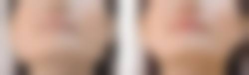 韩国EFIL整形医院 - 面部轮廓专科正规吗？看资质