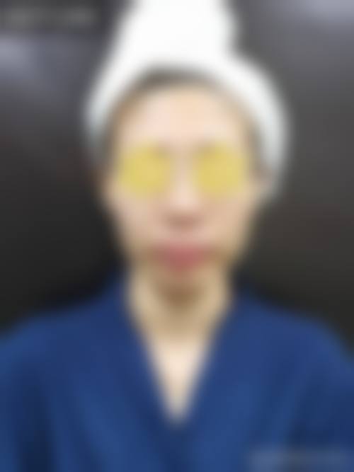 北京赵玉明整形医院怎么预约？