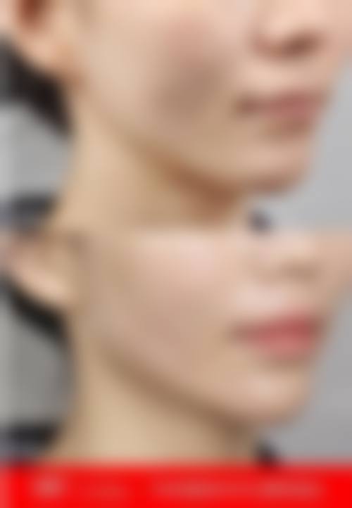 西安盛世美颜整形医院怎么预约?