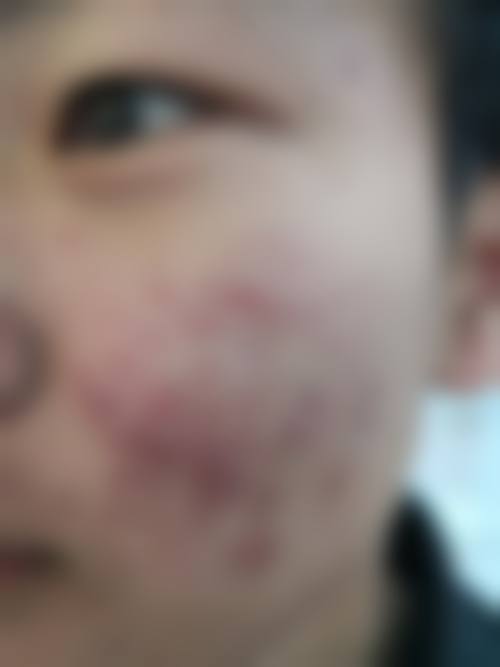 辽宁大连新京城皮肤科门诊部怎么预约?