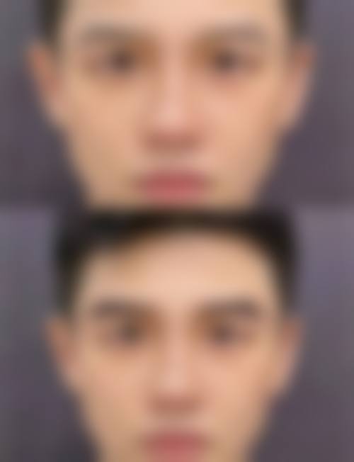 台州昊阳医疗美容医院怎么预约？