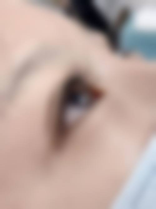 郑州百禾植发医院怎么预约？