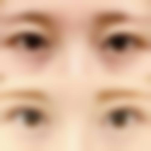 凉山彝族自治州第一人民医院烧伤整形科实例参考