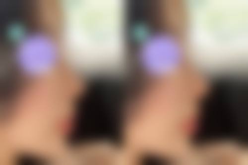 凉山彝族自治州第一人民医院烧伤整形科医生团队