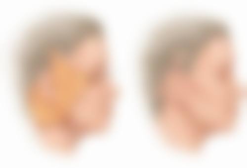 胡中华擅长项目列表