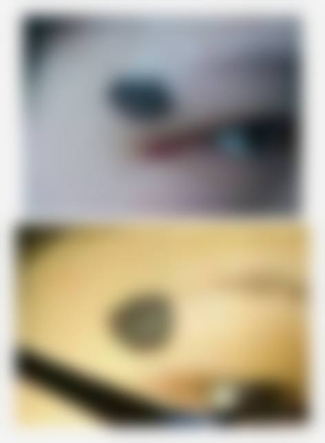 沈阳和美妇产医院整形科实例参考