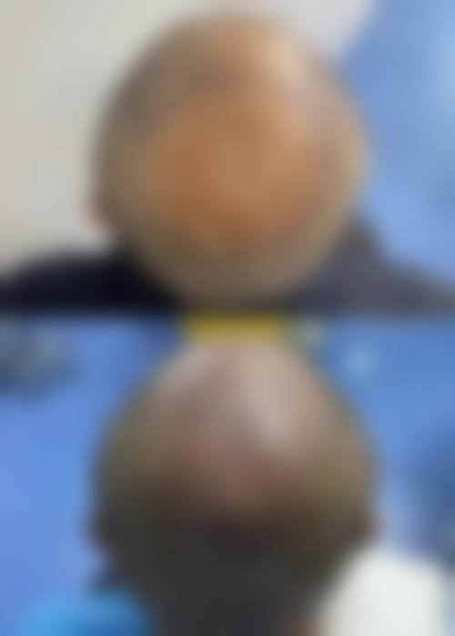 洛阳名门整形医院怎么预约？