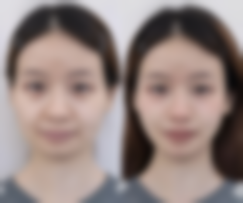 泉州欧菲整形门诊部核心项目