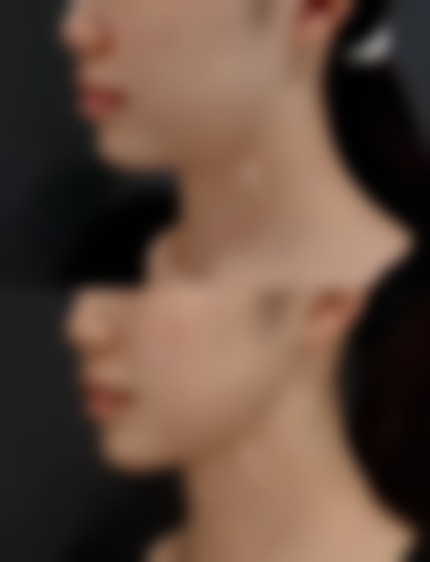 泉州欧菲整形门诊部怎么预约？