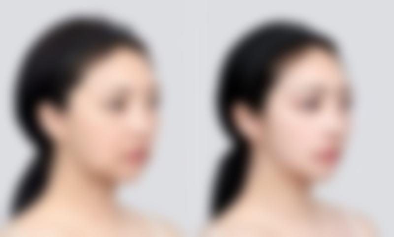 何汀擅长项目列表