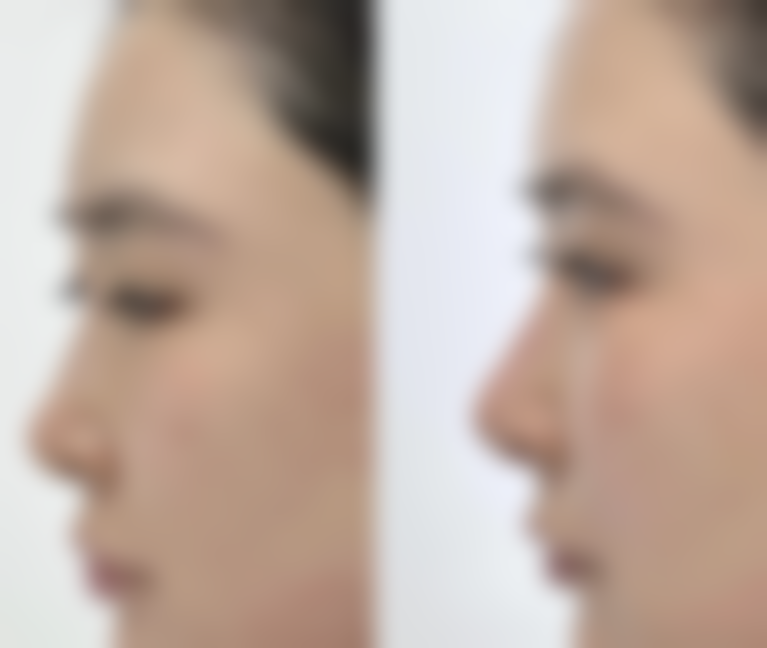 张文红擅长项目列表