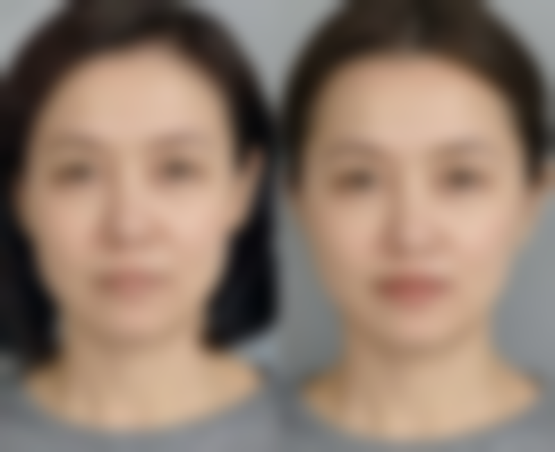 孙东原擅长项目列表