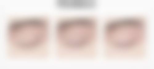 郑州美眼医疗美容中 心实例参考