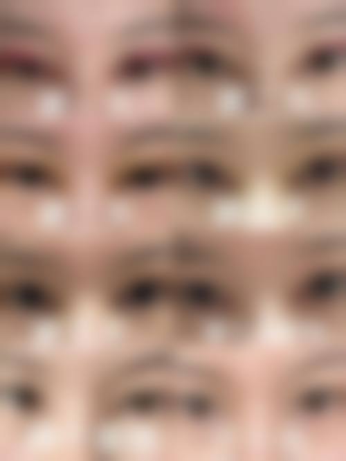 九江瑞丽整形医院实例参考