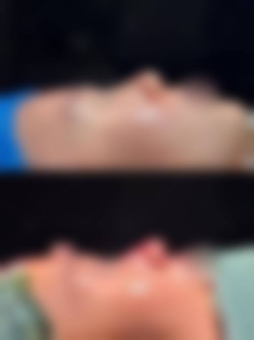 九江瑞丽整形医院价格表（仅供参考）