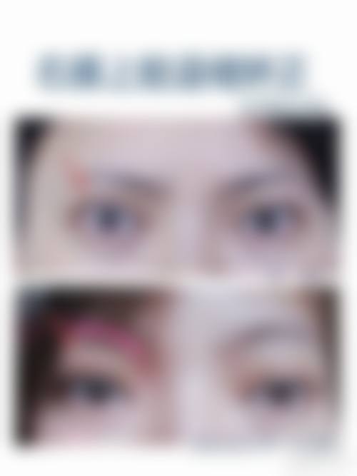 兰州军区陆 军总院整形美容中 心怎么预约？