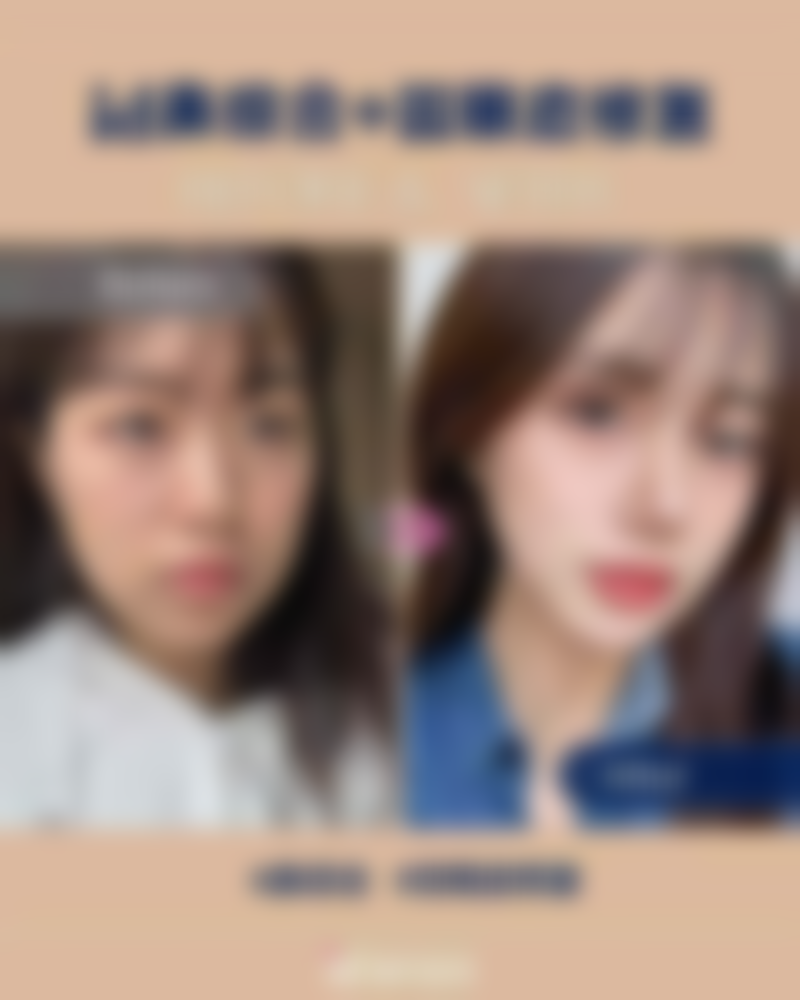 佛山市第一人民医院（整形美容二科）实例参考