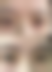 淮南东方医院集团谢一医院肿 瘤科实例参考