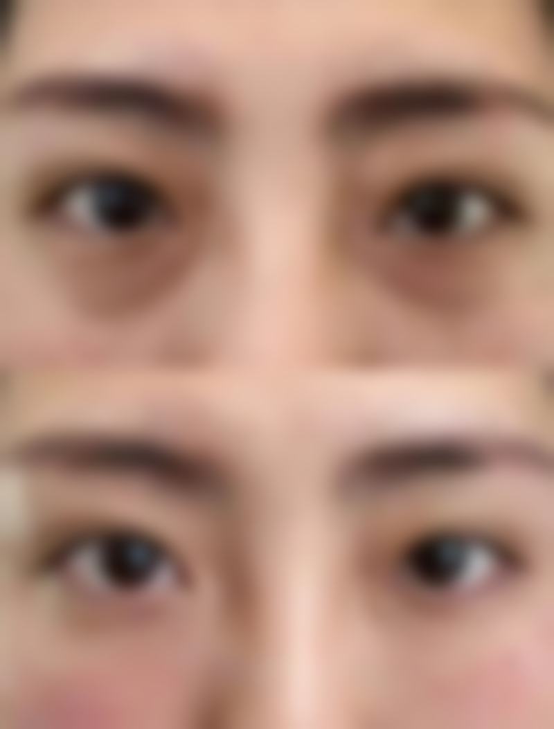 郑州蕾娜斯医疗美容医院实例参考