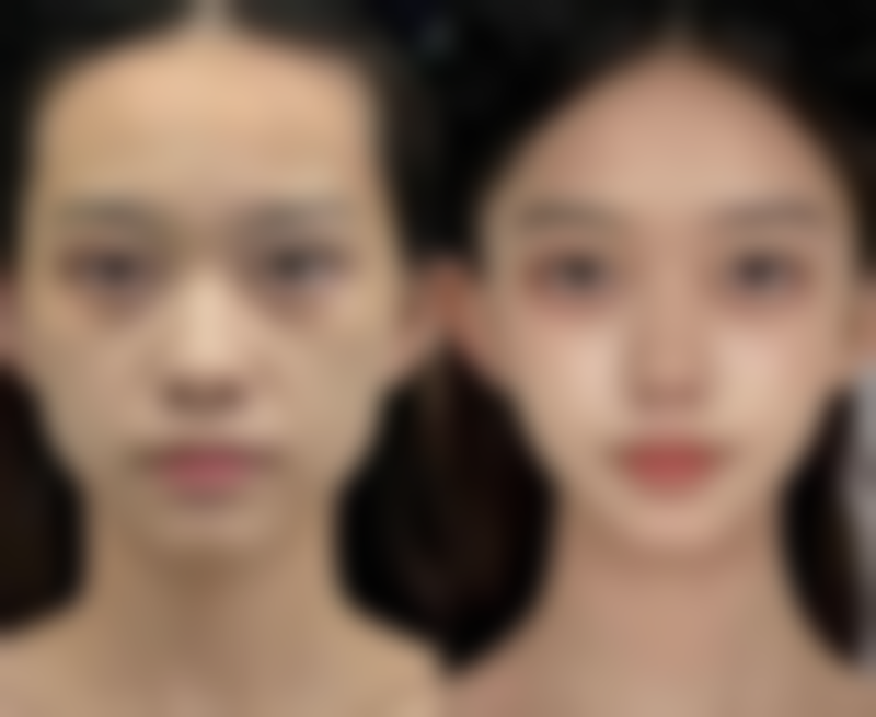 郑州蕾娜斯医疗美容医院怎么预约?