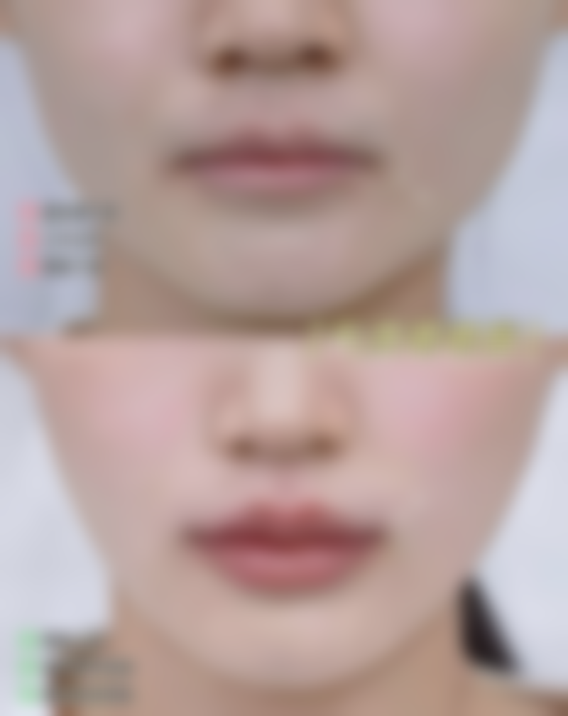 张运强患者评价