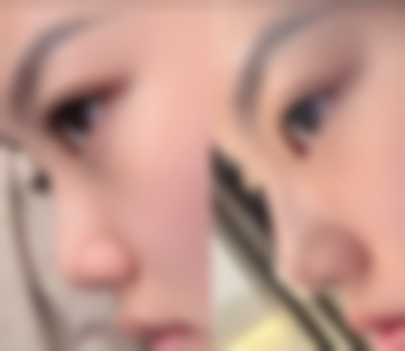 易平光预约方式