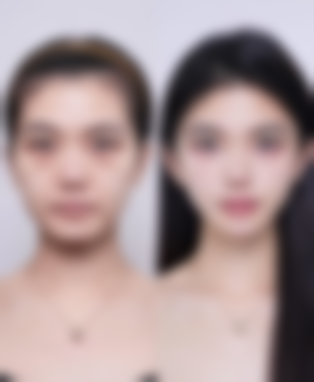 易平光患者评价