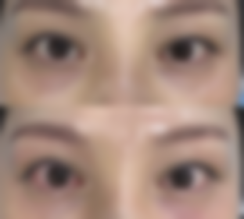 杭州越妍整形医院正规吗?看资质