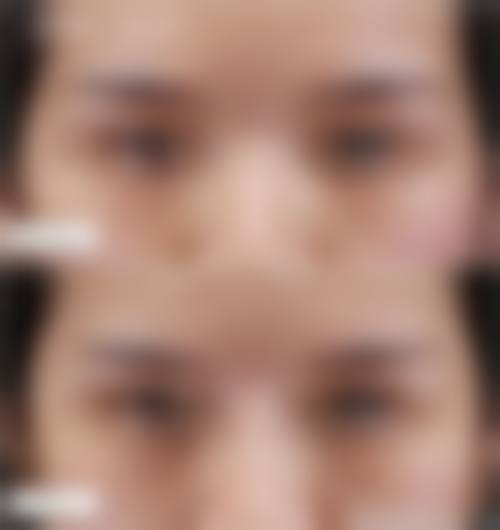 义乌卡丽(依美壹家)医疗美容诊所核心项目