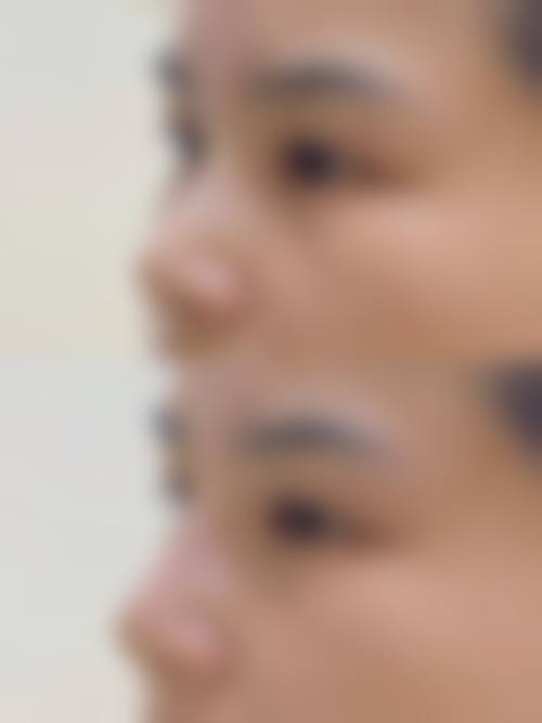 郑州丽天整形医院实例参考