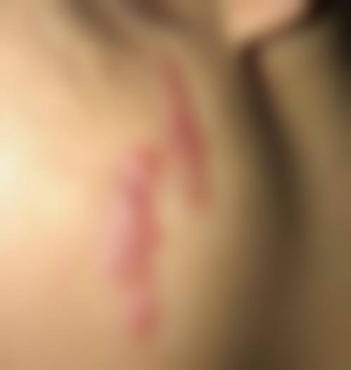 成都修肤堂皮肤病整形诊所怎么预约？