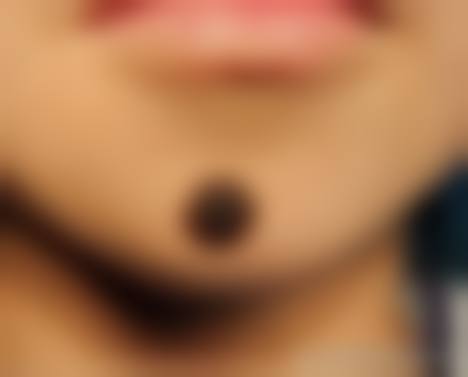 成都修肤堂皮肤病整形诊所价格表（仅供参考）