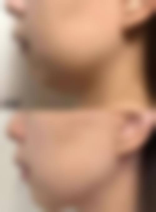 周口烧伤医院医学美容科怎么预约？