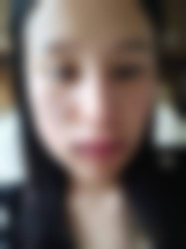 郑州丽天整形医院价格表（仅供参考）