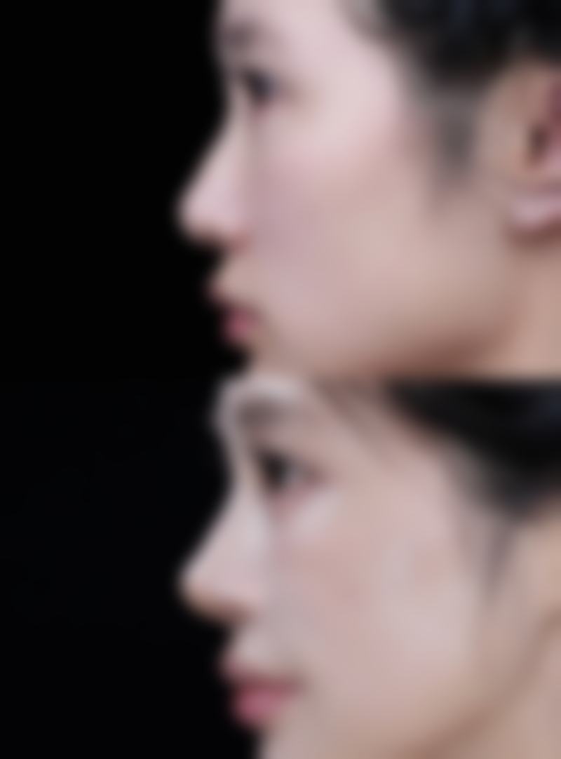 郑州丽天整形医院怎么预约？