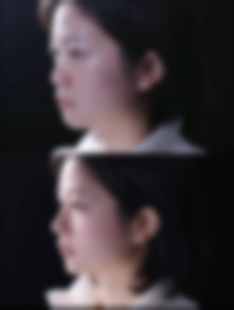 南充新韵悦美整形美容医院实例参考