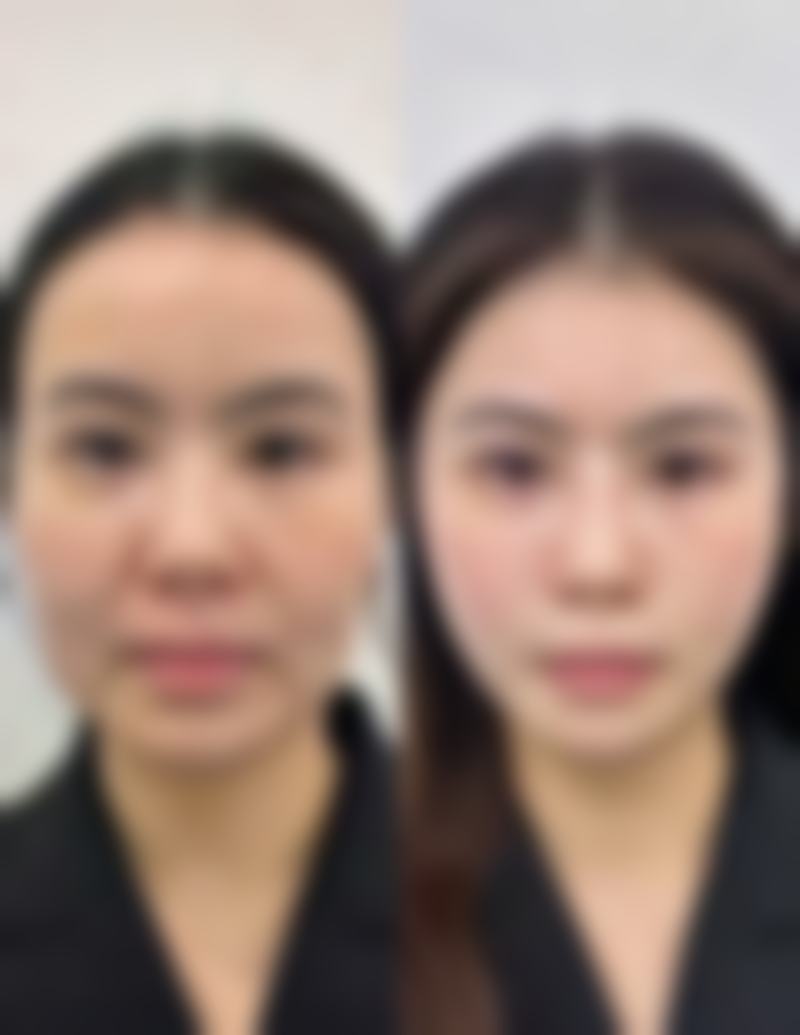 苏州湖悦沐兰清颜整形医院价格表（仅供参考）