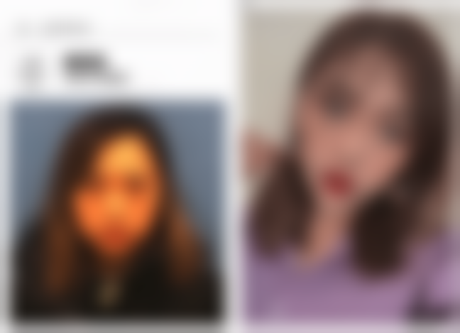 窦玺医生：隆胸界的实力担当