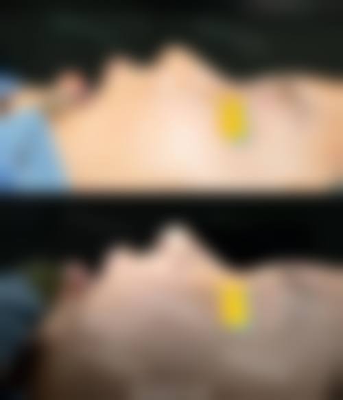 韩国For U整形外科医院价格表（仅供参考）