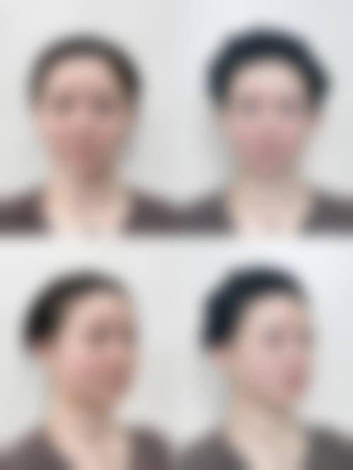 珠海大懒虫医疗美容诊所核心项目