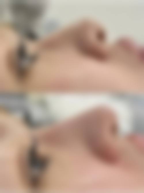 陈芳擅长项目列表