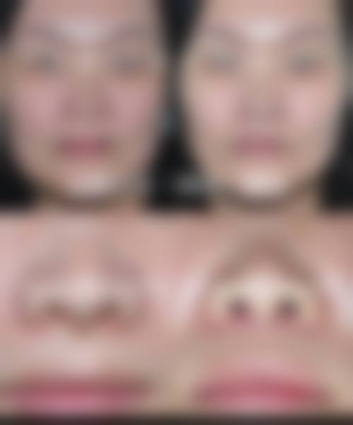 衢州雪荣医院整形美容中 心价格表(仅供参考)