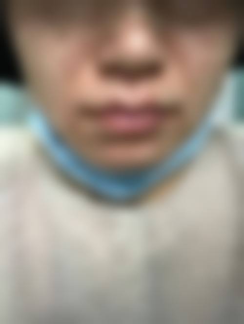 成都锦江菁薇整形医院怎么预约？