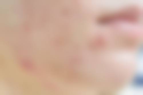 汉中市中医医院皮肤科怎么预约?