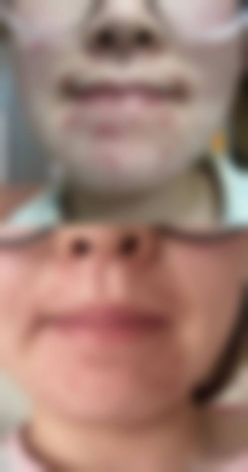 汉中市中医医院皮肤科核心项目