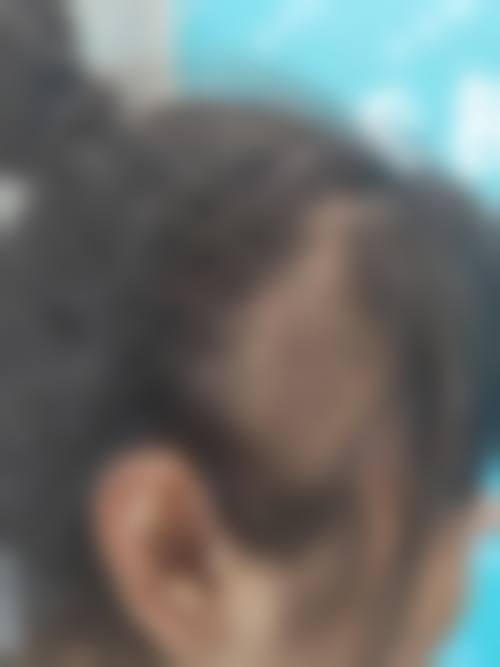 湖州新生植发爱美爱医疗美容诊所怎么预约？